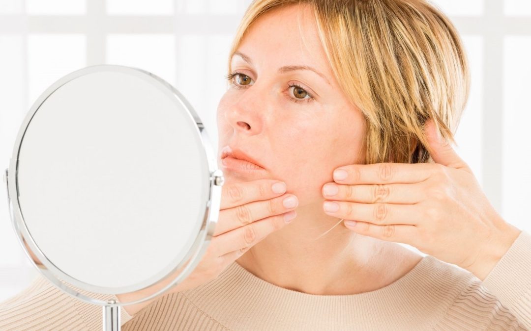 acné rosacée a plus de 50 ans
